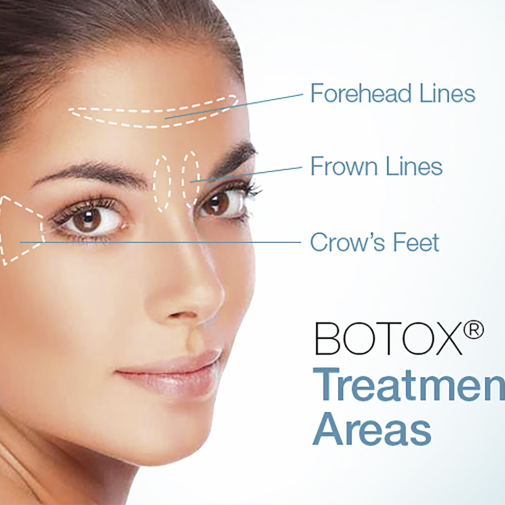 botox image